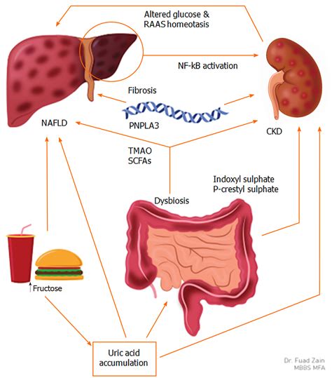 Non Alcoholic Fatty Liver And Chronic Kidney Disease Retrospect