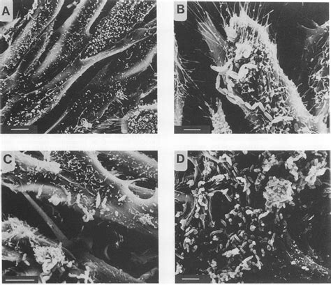 Scanning Electron Micrographs Of Cho Monolayers At Different Times