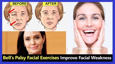 8 best facial exercises for bell s palsy improve your face weakness youtube