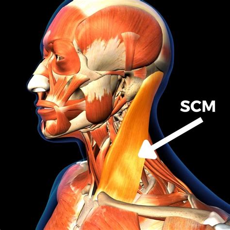 All Concerning The Sternocleidomastoid Muscle Anatomy And Therapy My