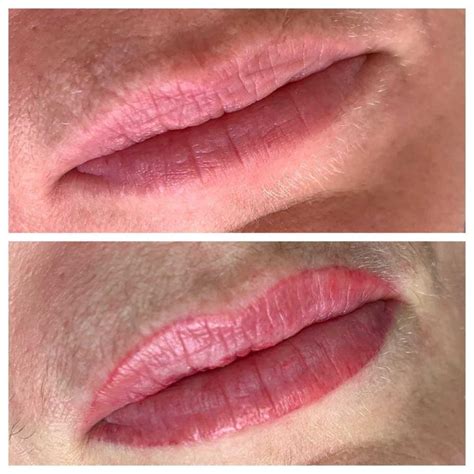 Would you get your lips colored? How Long Does Cosmetic Tattooing Last?