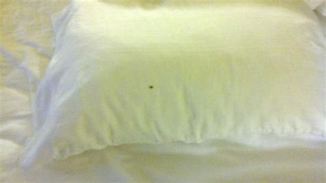 Bed Bug On Pillow Picture Of Holiday Inn Express Garden Grove Garden