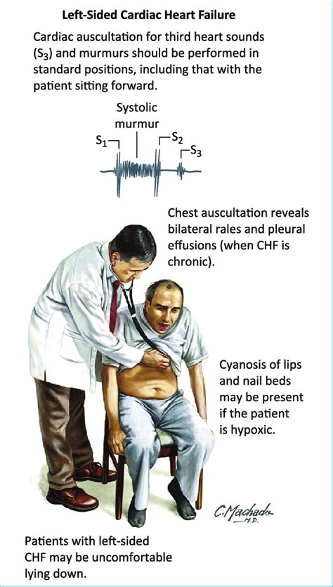 Physical Exam In Heart Failure Chf Chronic Heart Failure Adapted