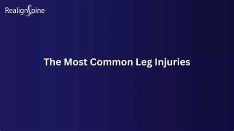 Ppt The Most Common Leg Injuries Powerpoint Presentation Free