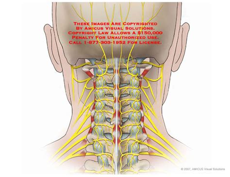AMICUS Illustration Of Amicus Anatomy Cervical Neck Posterior Nerves C1