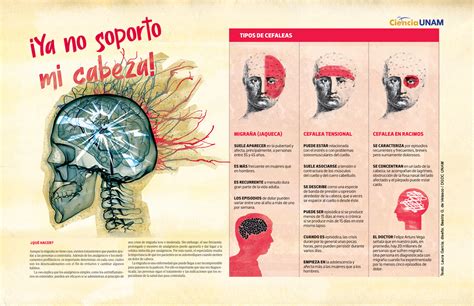 infograf a diferentes tipos de dolor de cabeza ciencia unam hot sex picture