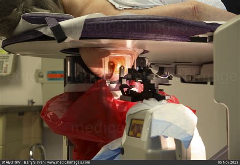 Stock Image Stereotactic Breast Biopsy Procedure The Vacuum Assisted