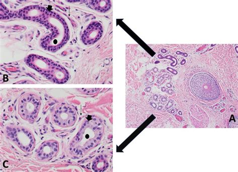 Apocrine Vs Eccrine Sweat Gland