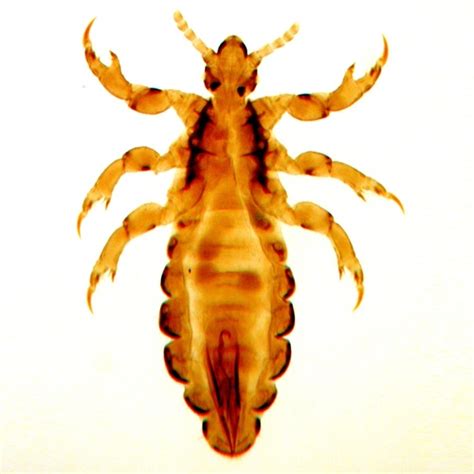 Pest Advice For Controlling Head Lice