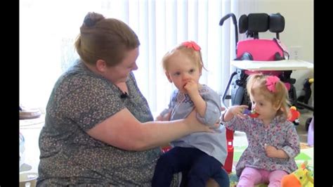 Formerly Conjoined Twins Thriving After Rare Complex Surgery Separated