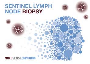 What Is Sentinel Lymph Node Biopsy Norgine Uk