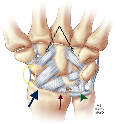 Volar Carpal Ligaments Wrist Anatomy Joints Anatomy Gross Anatomy My