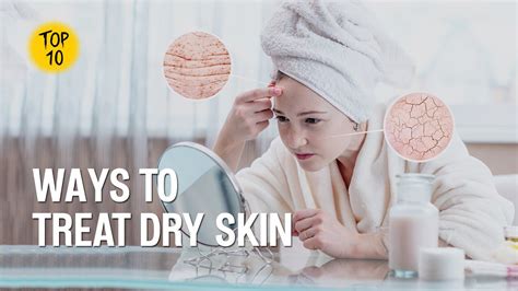 Top 10 Ways To Treat Dry Skin Youtube