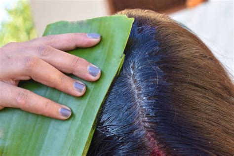 Aggregate More Than Aloe Vera Hair Treatment Benefits Best