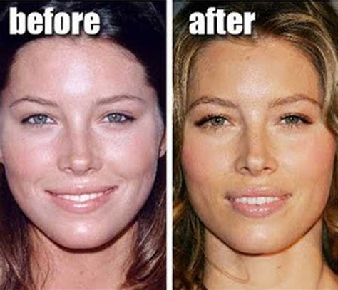 Jessica Biel Plastic Surgery Before And After Nose Job Lip Injection