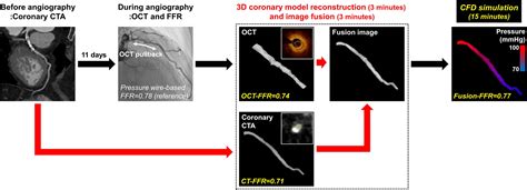 Frontiers Computational Fractional Flow Reserve From Coronary