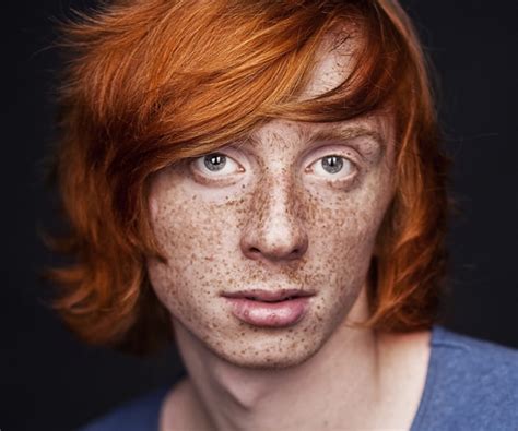 Redheads Skin Cancer Risk Like 21 Extra Years In The Sun