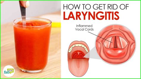 laryngitis home remedies 3 most powerful cures youtube