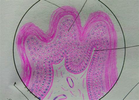 Histopathology Drawings Squamous Papilloma