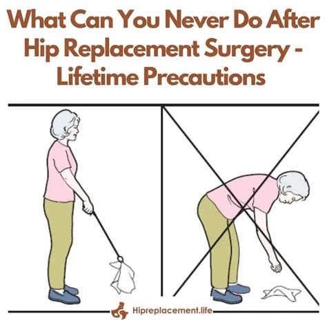 What Can You Never Do After Hip Replacement Surgery Lifetime Precautions