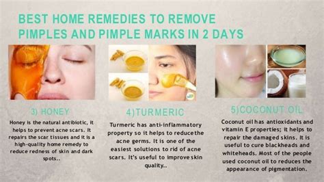 Best Home Remedies To Remove Pimples And Pimple Marks In 2 Days 1