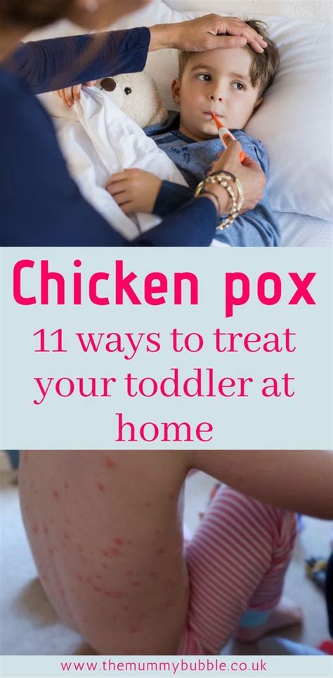 Pin On Chick Pox