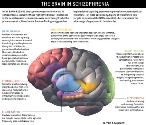 The Soloist Schizophrenia