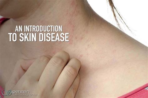 Applying Medical Skin Disease Terminology To The Common Skin Rash