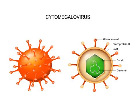 What Is Cytomegalovirus Cmv Signs Of Infection Vinmec