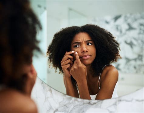 A Black Dermatologist Explains How To Clear Up Those Stubborn Dark