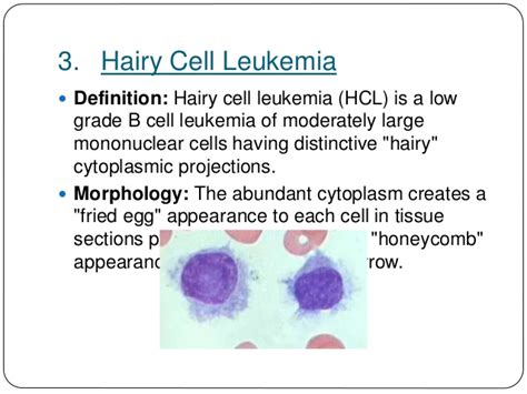 Leucaemias Lymphomas