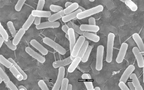 Sem Image For Bacillus Sphaericus Download Scientific Diagram