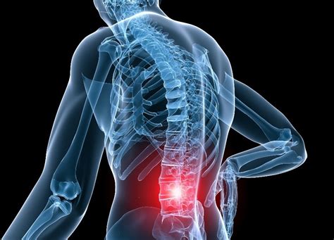 However, the spinal erectors travel the length of the entire spine. Low Back Strain and Sprain - Symptoms, Diagnosis and Treatments