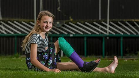Girls Leg Broken On Christchurch Trampolining Centres Opening Day