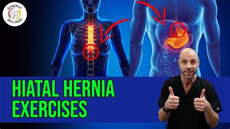 Best Hiatal Hernia Exercises Youtube In Herni Vrogue Co