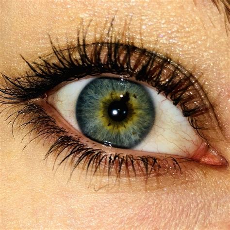 Central Heterochromia Green Eyes