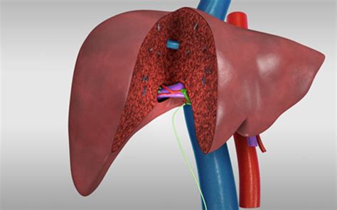 Liver Transplant Living Donor Right Posterior Sectionectomy Donor