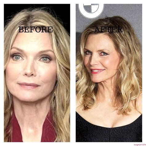 Michelle Pfeiffer S Plastic Surgery What S The Secret Vrogue Co