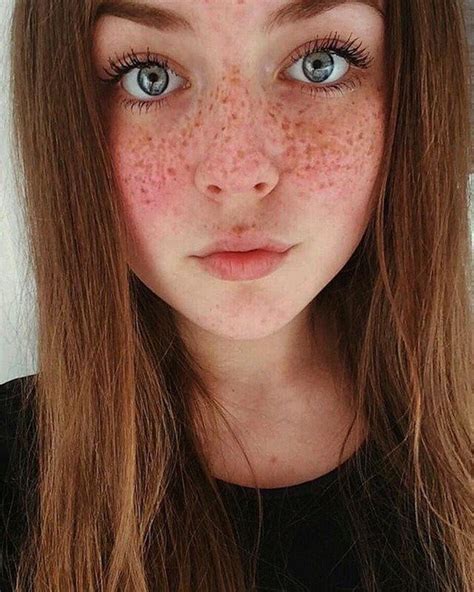 Girls With Freckles Pics
