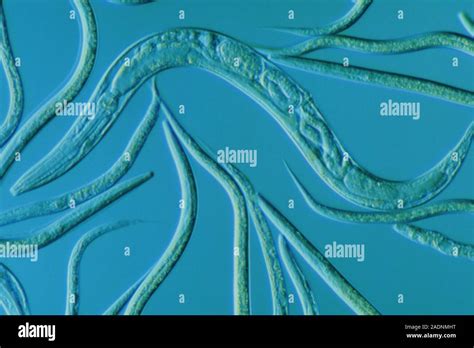 Light Micrograph Of Caenorhabditis Elegans A Soil Dwelling Bisexual