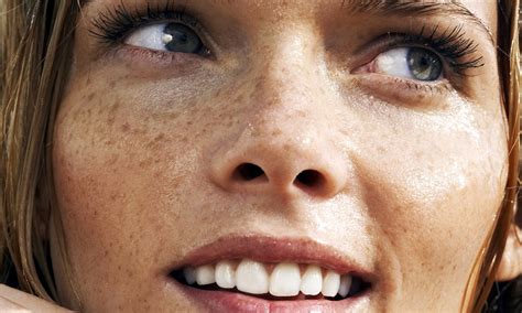 8 Best Freckle Removal Creams Reviews 2018 Bumpsundereyes Anti