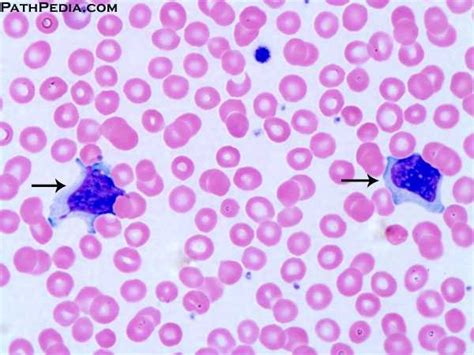 Level 6 Haematology Memrise