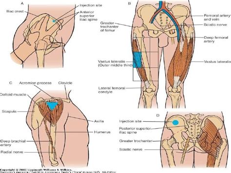 Intramuscular• Ventrogluteal Muscles The Ventrogluteal Muscles Make Up The Other Preferred Site