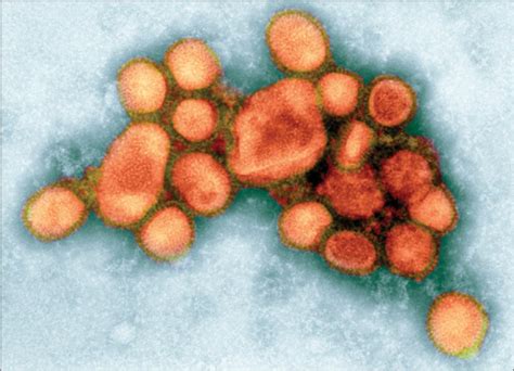 Research Brief The Lancet Infectious Diseases