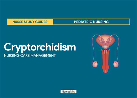 Cryptorchidism Is A Condition Present At Birth In Which One Or Both