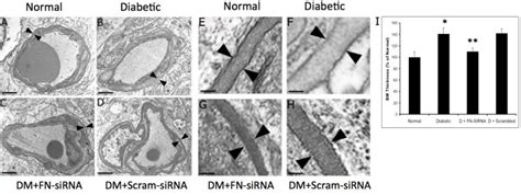 We did not find results for: Electron microscopy (EM) analysis of capillary basement ...