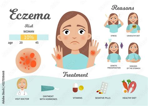 Infographics Of Eczema Statistics Causes Treatment Of The Disease