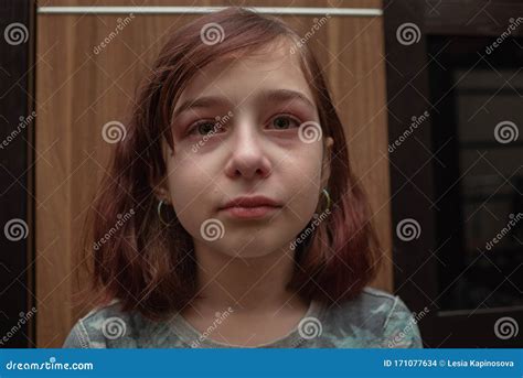 Retrato De Niña Llorando Con Lágrimas Por Sus Mejillas Una Chica De 9