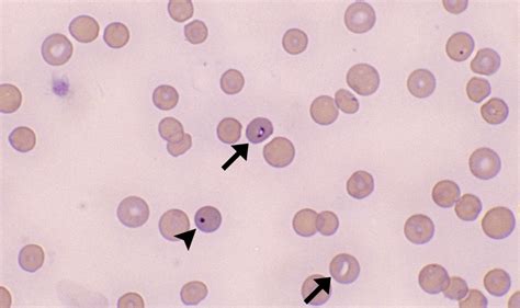 Babesia Cells And Smears