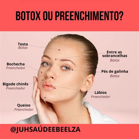 Botox Ou Preenchimento Em Botox Preenchimento Facial Preenchimento